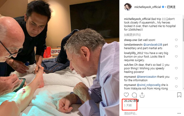 杨紫琼在个人社交网站晒出一张照片，透露旅行时不慎弄伤了腿，而男友Todt则十分紧张地趴在病床上。